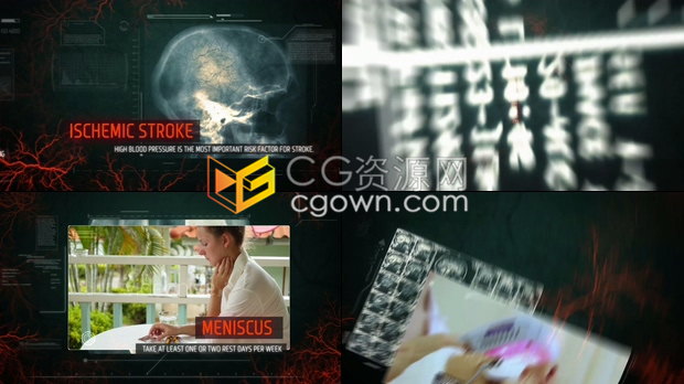 X射线高科技扫描静脉图像HUD元素动画镜头医疗健康医学宣传包装-AE模板