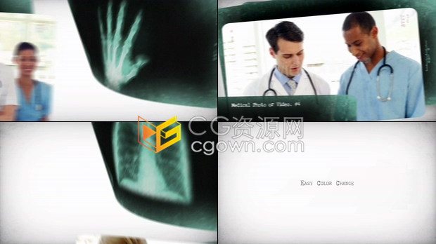 AE模板X射线骨骼拍片实验室医学介绍宣传科学医疗医院宣传片