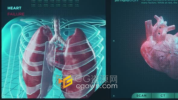 视频素材-HUD信息图心力衰竭功能心脏病疾病医学医疗保健系统屏幕全息概念