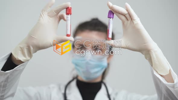 医生在实验室比较COVID-19阳性患者血样新型冠状病毒肺炎实拍视频素材